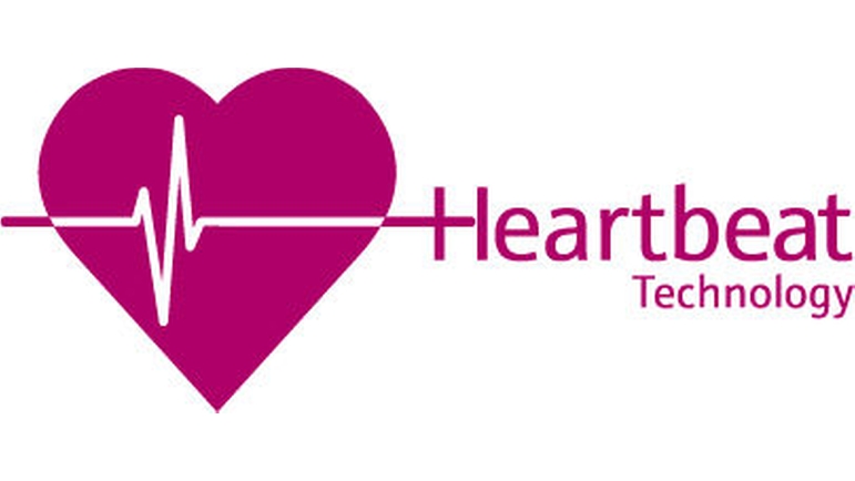 Heartbeat テクノロジー