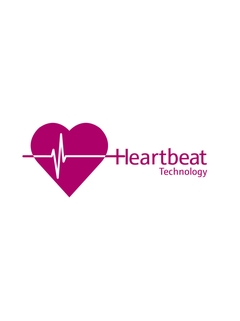 Heartbeat Technology は、測定ポイントの診断、検証、およびモニタリングを提供します。